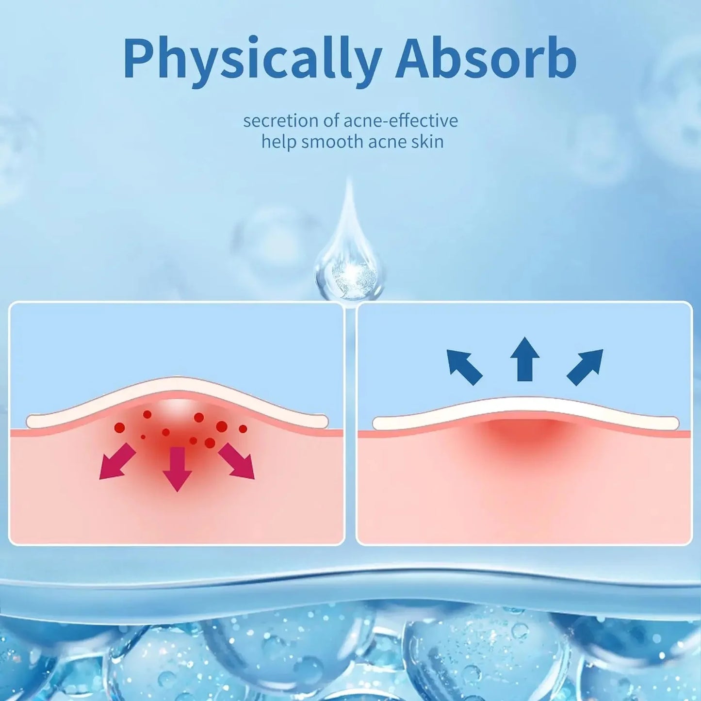 24pcs Acne Patches – Gentle Hydrocolloid Spot Covers, Waterproof & Dust-Free, Individually Wrapped, Absorbs Pimples