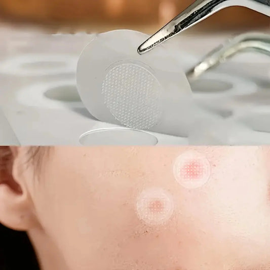 24pcs Acne Patches – Gentle Hydrocolloid Spot Covers, Waterproof & Dust-Free, Individually Wrapped, Absorbs Pimples